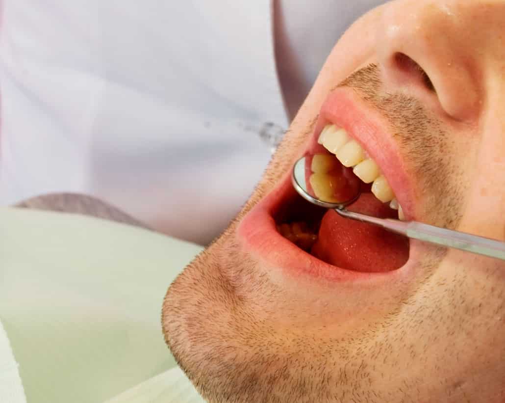 Prevenção odontológica: A melhor forma de economizar no tratamento