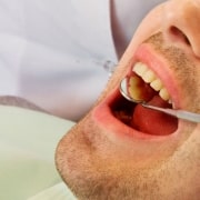 Prevenção odontológica: A melhor forma de economizar no tratamento